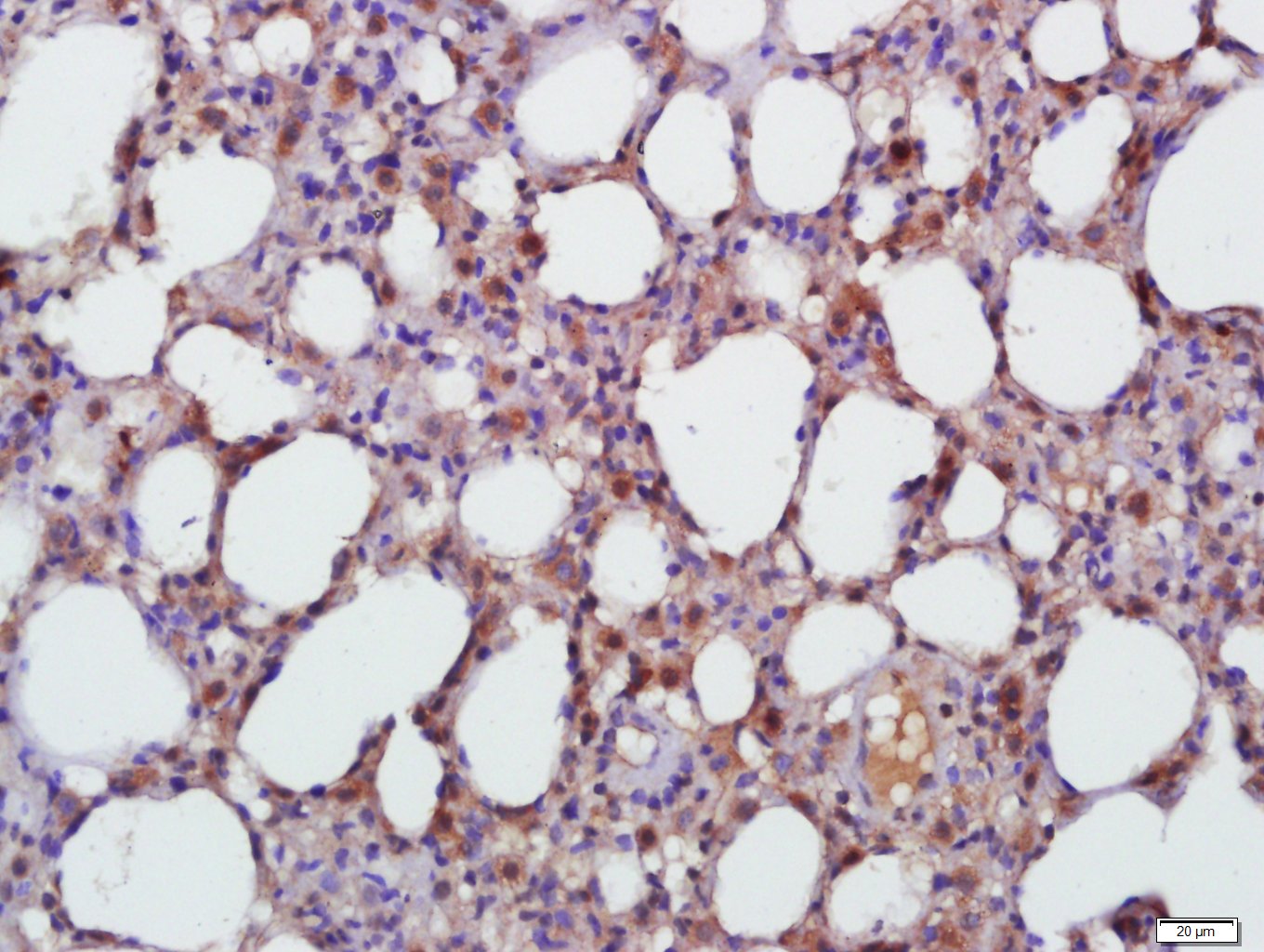 Paraformaldehyde-fixed, paraffin embedded Rat Lung; Antigen retrieval by boiling in sodium citrate buffer (pH6.0) for 15min; Block endogenous peroxidase by 3% hydrogen peroxide for 20 minutes; Blocking buffer (normal goat serum) at 37°C for 30min; Antibody incubation with TGF beta 1 Polyclonal Antibody, Unconjugated (bs-0086R) at 1:500 overnight at 4°C, DAB staining.