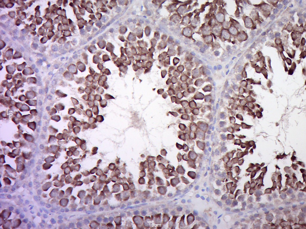 Paraformaldehyde-fixed, paraffin embedded Rat Testis; Antigen retrieval by boiling in sodium citrate buffer (pH6.0) for 15min; Block endogenous peroxidase by 3% hydrogen peroxide for 20 minutes; Blocking buffer (normal goat serum) at 37°C for 30min; Antibody incubation with CALCR Polyclonal Antibody, Unconjugated (bs-0124R) at 1:400 overnight at 4°C, DAB staining.