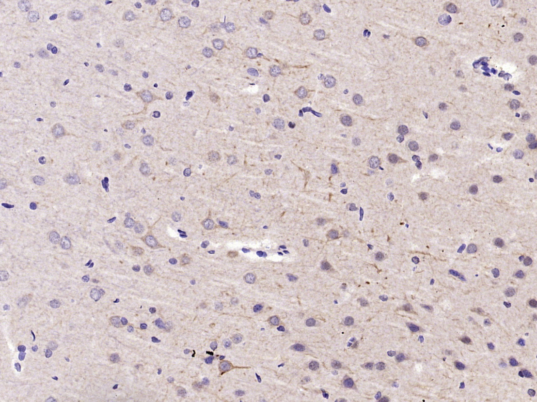 Paraformaldehyde-fixed, paraffin embedded Rat Brian; Antigen retrieval by boiling in sodium citrate buffer (pH6.0) for 15min; Block endogenous peroxidase by 3% hydrogen peroxide for 20 minutes; Blocking buffer (normal goat serum) at 37°C for 30min; Antibody incubation with HSP90 beta Polyclonal Antibody, Unconjugated (bs-0135R) at 1:400 overnight at 4°C, DAB staining.