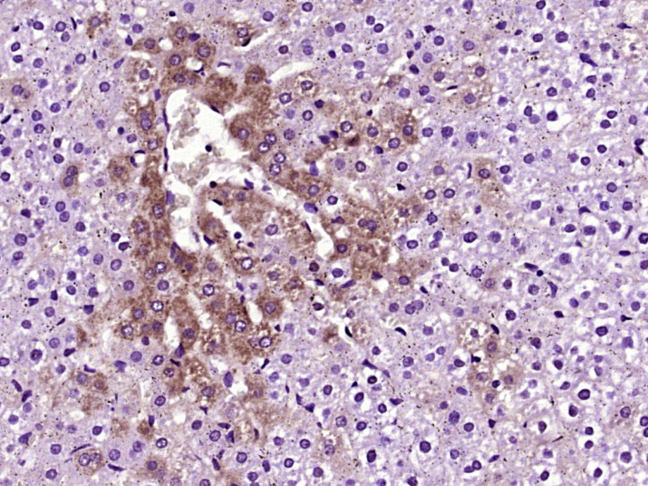 Paraformaldehyde-fixed, paraffin embedded Rat Liver; Antigen retrieval by boiling in sodium citrate buffer (pH6.0) for 15min; Block endogenous peroxidase by 3% hydrogen peroxide for 20 minutes; Blocking buffer (normal goat serum) at 37°C for 30min; Antibody incubation with TTR Prealbumin beta Polyclonal Antibody, Unconjugated (bs-0152R) at 1:400 overnight at 4°C, DAB staining.