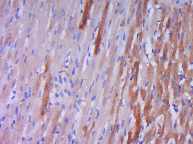 Paraformaldehyde-fixed, paraffin embedded rat heart muscle; Antigen retrieval by boiling in sodium citrate buffer (pH6.0) for 15min; Block endogenous peroxidase by 3% hydrogen peroxide for 20 minutes; Blocking buffer (normal goat serum) at 37°C for 30min; Antibody incubation with Big endothelin-1 Polyclonal Antibody, Unconjugated (bs-0188R) at 1:400 overnight at 4°C, DAB staining.