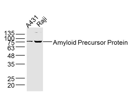 Lane 1: A431 lysates; Lane 2: Raji lysates; Jurkat lysates probed with Amyloid Precursor Protein Antibody, Unconjugated (bs-0112R) at 1:300 dilution and 4˚C overnight incubation. Followed by conjugated secondary antibody incubation at 1:10000 for 60 min at 37˚C.