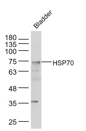 Mouse bladder lysates probed with HSP70 Polyclonal Antibody, Unconjugated (bs-0126R) at 1:300 dilution and 4˚C overnight incubation. Followed by conjugated secondary antibody incubation at 1:10000 for 60 min at 37˚C.