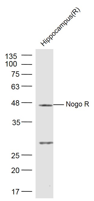 Rat Hippocampus lysates probed with Nogo Receptor Polyclonal Antibody, Unconjugated (bs-0129R) at 1:500 dilution and 4˚C overnight incubation. Followed by conjugated secondary antibody incubation at 1:10000 for 60 min at 37˚C.