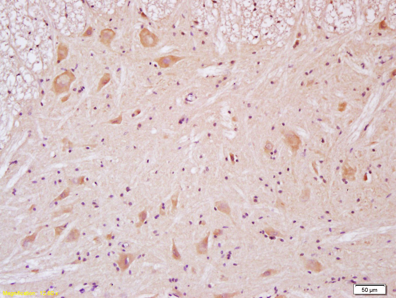 Paraformaldehyde-fixed, paraffin embedded Rat Spinal Cord; Antigen retrieval by boiling in sodium citrate buffer (pH6.0) for 15min; Block endogenous peroxidase by 3% hydrogen peroxide for 20 minutes; Blocking buffer (normal goat serum) at 37°C for 30min; Antibody incubation with NR2B Polyclonal Antibody, Unconjugated (bs-0222R) at 1:200 overnight at 4°C, DAB staining.