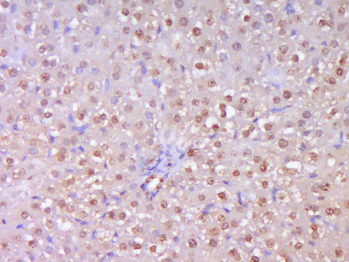 Paraformaldehyde-fixed, paraffin embedded Rat Liver; Antigen retrieval by boiling in sodium citrate buffer (pH6.0) for 15min; Block endogenous peroxidase by 3% hydrogen peroxide for 20 minutes; Blocking buffer (normal goat serum) at 37°C for 30min; Antibody incubation with TERT Polyclonal Antibody, Unconjugated (bs-0233R) at 1:400 overnight at 4°C, DAB staining.