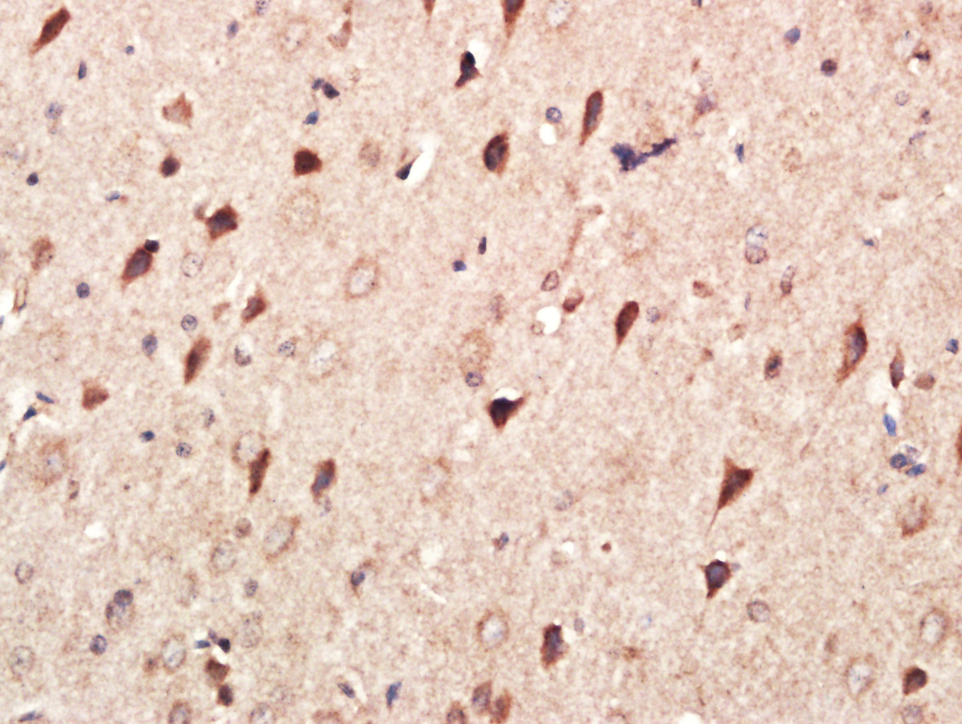 Paraformaldehyde-fixed, paraffin embedded Rat Brain; Antigen retrieval by boiling in sodium citrate buffer (pH6.0) for 15min; Block endogenous peroxidase by 3% hydrogen peroxide for 20 minutes; Blocking buffer (normal goat serum) at 37°C for 30min; Antibody incubation with mmp2 Polyclonal Antibody, Unconjugated (bs-0412R) at 1:400 overnight at 4°C, DAB staining.