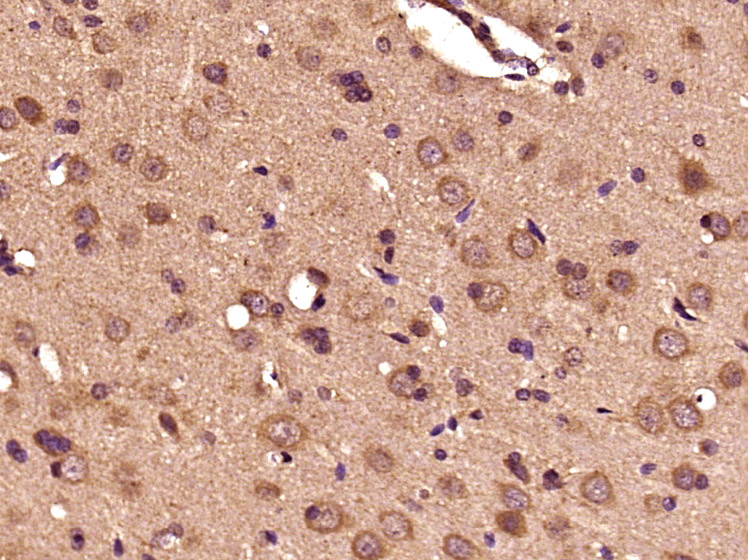 Paraformaldehyde-fixed, paraffin embedded Rat brain; Antigen retrieval by boiling in sodium citrate buffer (pH6.0) for 15min; Block endogenous peroxidase by 3% hydrogen peroxide for 20 minutes; Blocking buffer (normal goat serum) at 37°C for 30min; Antibody incubation with DBH Polyclonal Antibody, Unconjugated (bs-0596R) at 1:400 overnight at 4°C, DAB staining.