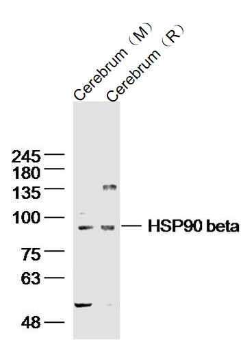 Lane 1: mouse cerebrum lysates; Lane 2: rat cerebrum lysates probed with HSP90 beta Polyclonal Antibody, Unconjugated (bs-0135R) at 1:300 dilution and 4˚C overnight incubation. Followed by conjugated secondary antibody incubation at 1:10000 for 60 min at 37˚C.