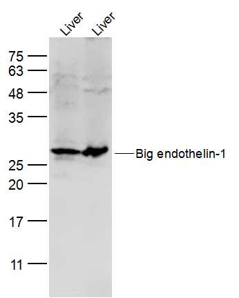 Lane 1: mouse liver lysates; Lane 2: rat liver lysates probed with Preproendothelin 1 Polyclonal Antibody, Unconjugated (bs-0188R) at 1:300 dilution and 4˚C overnight incubation. Followed by conjugated secondary antibody incubation at 1:10000 for 60 min at 37˚C.