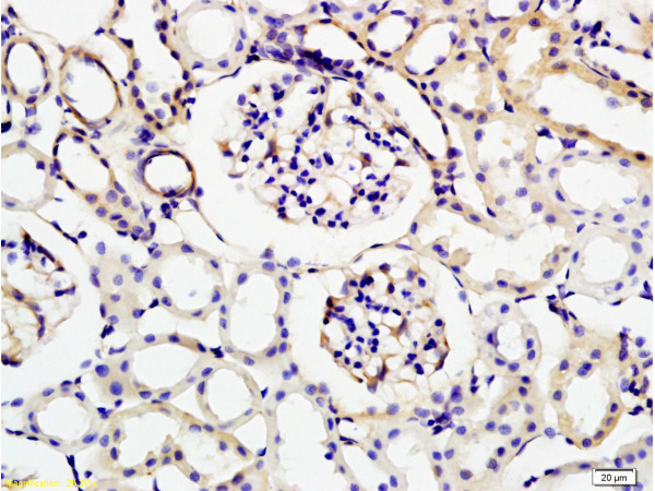 Formalin-fixed and rat kidney tissue labeled with Anti-KLK1 Polyclonal Antibody (bs-1963R), Unconjugated at 1:200 followed by conjugation to the secondary antibody and DAB staining Formalin-fixed and rat kidney tissue labeled with Anti-KLK1 Polyclonal Antibody (bs-1963R), Unconjugated at 1:200 followed by conjugation to the secondary antibody and DAB staining
