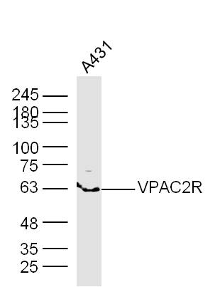A431 lysates probed with VPAC2R Polyclonal Antibody, Unconjugated (bs-0197R) at 1:300 dilution and 4˚C overnight incubation. Followed by conjugated secondary antibody incubation at 1:10000 for 60 min at 37˚C.