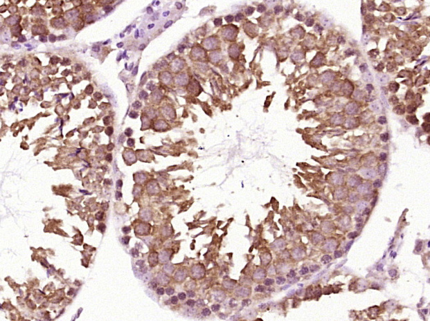 Paraformaldehyde-fixed, paraffin embedded Mouse testis; Antigen retrieval by boiling in sodium citrate buffer (pH6.0) for 15min; Block endogenous peroxidase by 3% hydrogen peroxide for 20 minutes; Blocking buffer (normal goat serum) at 37°C for 30min; Antibody incubation with HSP90 alpha Polyclonal Antibody, Unconjugated (bs-10100R) at 1:400 overnight at 4°C, DAB staining.