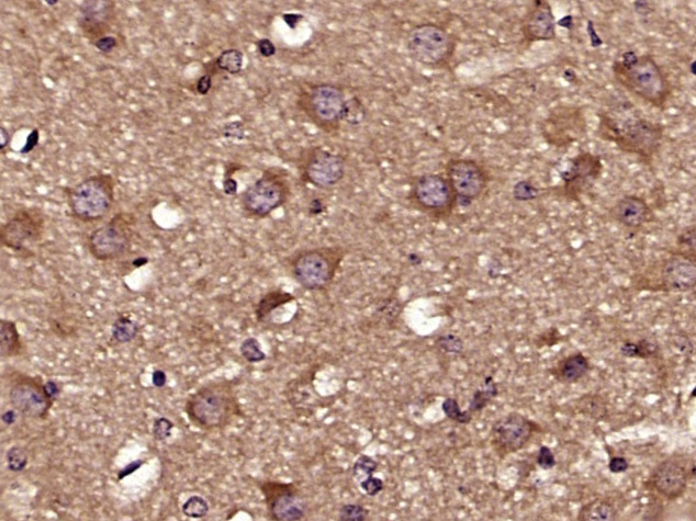 Paraformaldehyde-fixed, paraffin embedded Mouse brain; Antigen retrieval by boiling in sodium citrate buffer (pH6.0) for 15min; Block endogenous peroxidase by 3% hydrogen peroxide for 20 minutes; Blocking buffer (normal goat serum) at 37°C for 30min; Antibody incubation with Tau protein (Ser579) Polyclonal Antibody, Unconjugated (bs-10108R) at 1:400 overnight at 4°C, DAB staining.