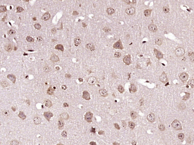 Paraformaldehyde-fixed, paraffin embedded Mouse brain; Antigen retrieval by boiling in sodium citrate buffer (pH6.0) for 15min; Block endogenous peroxidase by 3% hydrogen peroxide for 20 minutes; Blocking buffer (normal goat serum) at 37°C for 30min; Antibody incubation with Caspase-6 subunit p11 Polyclonal Antibody, Unconjugated (bs-10135R) at 1:400 overnight at 4°C, DAB staining. Paraformaldehyde-fixed, paraffin embedded Mouse brain; Antigen retrieval by boiling in sodium citrate buffer (pH6.0) for 15min; Block endogenous peroxidase by 3% hydrogen peroxide for 20 minutes; Blocking buffer (normal goat serum) at 37°C for 30min; Antibody incubation with Caspase-6 subunit p11 Polyclonal Antibody, Unconjugated (bs-10135R) at 1:400 overnight at 4°C, DAB staining.