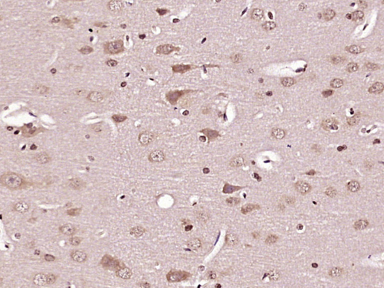Paraformaldehyde-fixed, paraffin embedded Rat brain; Antigen retrieval by boiling in sodium citrate buffer (pH6.0) for 15min; Block endogenous peroxidase by 3% hydrogen peroxide for 20 minutes; Blocking buffer (normal goat serum) at 37°C for 30min; Antibody incubation with Caspase-6 subunit p11 Polyclonal Antibody, Unconjugated (bs-10135R) at 1:400 overnight at 4°C, DAB staining.
