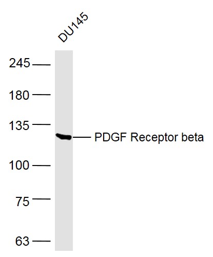 DU145 lysates probed with PDGF Receptor beta Polyclonal Antibody, Unconjugated (bs-0232R) at 1:500 dilution and 4˚C overnight incubation. Followed by conjugated secondary antibody incubation at 1:10000 for 60 min at 37˚C.