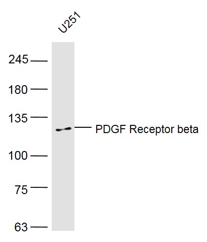 U251 lysates probed with PDGF Receptor beta Polyclonal Antibody, Unconjugated (bs-0232R) at 1:500 dilution and 4˚C overnight incubation. Followed by conjugated secondary antibody incubation at 1:10000 for 60 min at 37˚C.
