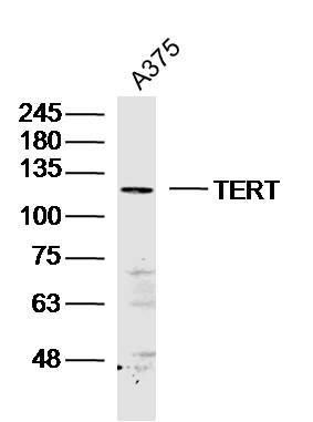 A375 lysates probed with TERT Polyclonal Antibody, Unconjugated (bs-0233R) at 1:300 dilution and 4˚C overnight incubation. Followed by conjugated secondary antibody incubation at 1:10000 for 60 min at 37˚C.