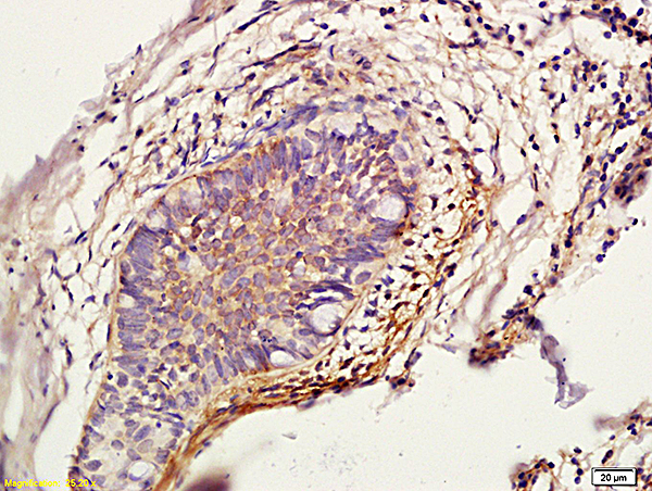 Formalin-fixed and paraffin embedded rat skin labeled with Anti-Cathepsin L\/CTSL Polyclonal Antibody (bs-1508R), Unconjugated  followed by conjugation to the secondary antibody and DAB staining