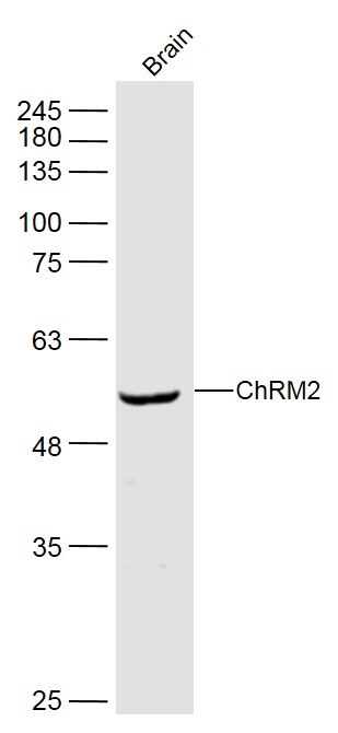 Mouse brain lysates probed with ChRM2 Polyclonal Antibody, Unconjugated (bs-0236R) at 1:500 dilution and 4˚C overnight incubation. Followed by conjugated secondary antibody incubation at 1:10000 for 60 min at 37˚C.
