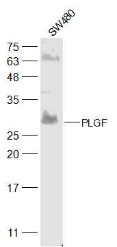 SW480 lysates probed with PLGF Polyclonal Antibody, Unconjugated (bs-0281R) at 1:300 dilution and 4˚C overnight incubation. Followed by conjugated secondary antibody incubation at 1:10000 for 60 min at 37˚C.