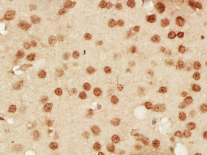 Paraformaldehyde-fixed, paraffin embedded Mouse brain; Antigen retrieval by boiling in sodium citrate buffer (pH6.0) for 15min; Block endogenous peroxidase by 3% hydrogen peroxide for 20 minutes; Blocking buffer (normal goat serum) at 37°C for 30min; Antibody incubation with DNA PKcs Polyclonal Antibody, Unconjugated (bs-10994R) at 1:400 overnight at 4°C, DAB staining.