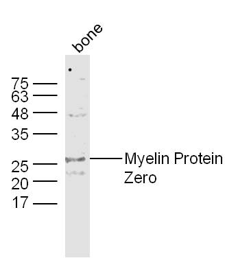 Bone lysates probed with Myelin Protein Zero Polyclonal Antibody, Unconjugated (bs-0337R) at 1:300 dilution and 4˚C overnight incubation. Followed by conjugated secondary antibody incubation at 1:10000 for 60 min at 37˚C.
