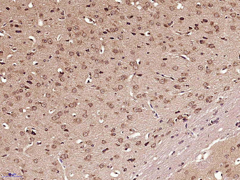 Paraformaldehyde-fixed, paraffin embedded Mouse brain; Antigen retrieval by boiling in sodium citrate buffer (pH6.0) for 15min; Block endogenous peroxidase by 3% hydrogen peroxide for 20 minutes; Blocking buffer (normal goat serum) at 37°C for 30min; Antibody incubation with GLI1 Polyclonal Antibody, Unconjugated (bs-1206R) at 1:400 overnight at 4°C, DAB staining.