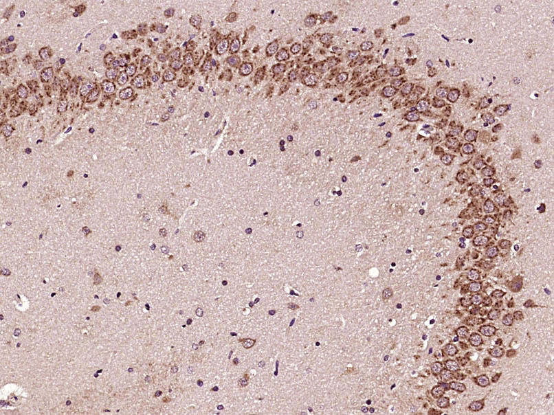 Paraformaldehyde-fixed, paraffin embedded Rat brain; Antigen retrieval by boiling in sodium citrate buffer (pH6.0) for 15min; Block endogenous peroxidase by 3% hydrogen peroxide for 20 minutes; Blocking buffer (normal goat serum) at 37°C for 30min; Antibody incubation with GLI1 Polyclonal Antibody, Unconjugated (bs-1206R) at 1:400 overnight at 4°C, DAB staining.