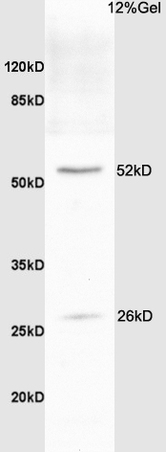 Rat brain lysate probed with Anti Bcl-xL/BCL2L1/bcl-xs Polyclonal Antibody, Unconjugated (bs-1336R) at 1:200 overnight at 4˚C. Followed by conjugation to secondary antibody (bs-0295G-HRP) at 1:3000 for 90 min at 37˚C. Predicted band 26kD. Observed band size:26kD,52kD.\n