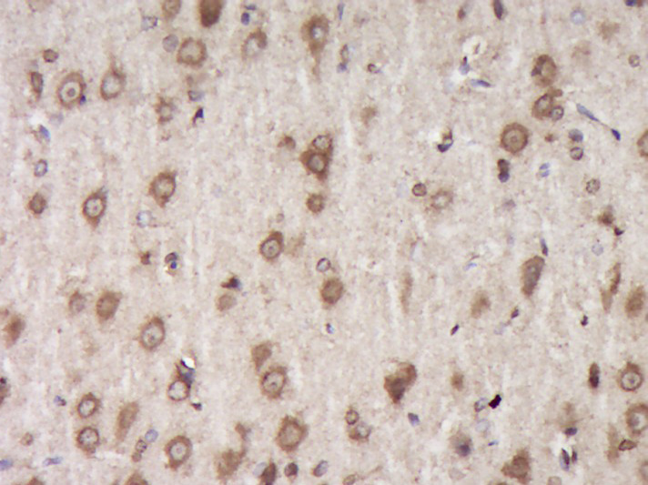 Paraformaldehyde-fixed, paraffin embedded Rat brain; Antigen retrieval by boiling in sodium citrate buffer (pH6.0) for 15min; Block endogenous peroxidase by 3% hydrogen peroxide for 20 minutes; Blocking buffer (normal goat serum) at 37°C for 30min; Antibody incubation with Fibromodulin Polyclonal Antibody, Unconjugated (bs-12362R) at 1:400 overnight at 4°C, DAB staining.
