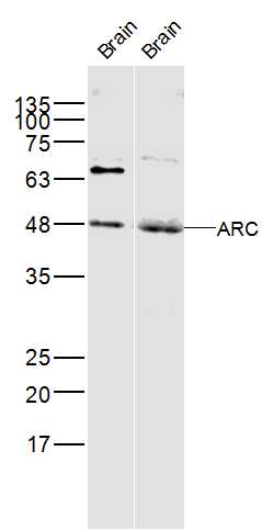 Lane 1: Rat brain; Lane 2: mouse brain lysate probed with ARC Polyclonal Antibody, Unconjugated (bs-0385R) at 1:300 dilution and 4˚C overnight incubation. Followed by conjugated secondary antibody incubation at 1:10000 for 60 min at 37˚C.