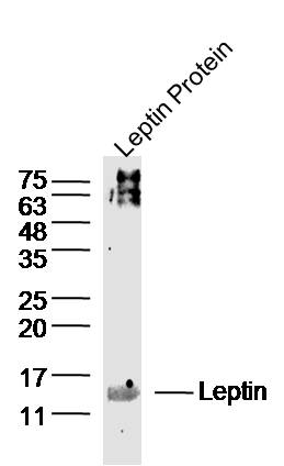 Leptin lysates probed with Leptin Polyclonal Antibody, Unconjugated (bs-0409R) at 1:300 dilution and 4˚C overnight incubation. Followed by conjugated secondary antibody incubation at 1:10000 for 60 min at 37˚C.