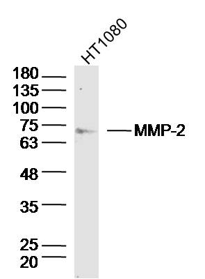 HT1080 lysates probed with MMP-2 Polyclonal Antibody, Unconjugated (bs-0412R) at 1:300 dilution and 4˚C overnight incubation. Followed by conjugated secondary antibody incubation at 1:10000 for 60 min at 37˚C.