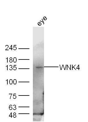 Mouse eye lysates probed with WNK4 Polyclonal Antibody, Unconjugated (bs-0429R) at 1:300 dilution and 4˚C overnight incubation. Followed by conjugated secondary antibody incubation at 1:10000 for 60 min at 37˚C.