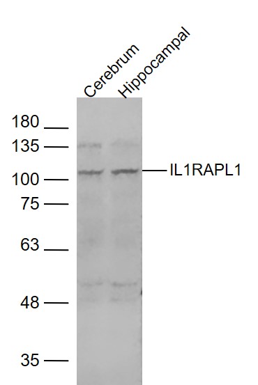 Lane 1: mouse cerebrum; Lane 2: mouse hippocampal lysates probed with IL1RAPL1 Polyclonal Antibody, Unconjugated (bs-0445R) at 1:1000 dilution and 4˚C overnight incubation. Followed by conjugated secondary antibody incubation at 1:10000 for 60 min at 37˚C.