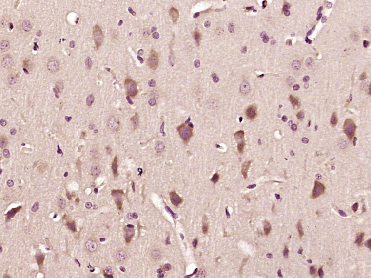 Paraformaldehyde-fixed, paraffin embedded Rat brain; Antigen retrieval by boiling in sodium citrate buffer (pH6.0) for 15min; Block endogenous peroxidase by 3% hydrogen peroxide for 20 minutes; Blocking buffer (normal goat serum) at 37°C for 30min; Antibody incubation with GABA B Receptor 2 Polyclonal Antibody, Unconjugated (bs-1293R) at 1:400 overnight at 4°C, DAB staining.