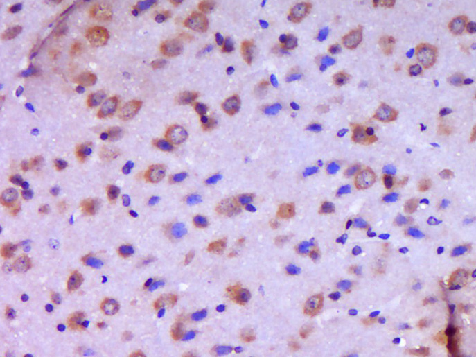 Paraformaldehyde-fixed, paraffin embedded Mouse brain; Antigen retrieval by boiling in sodium citrate buffer (pH6.0) for 15min; Block endogenous peroxidase by 3% hydrogen peroxide for 20 minutes; Blocking buffer (normal goat serum) at 37°C for 30min; Antibody incubation with JAMC Polyclonal Antibody, Unconjugated (bs-11086R) at 1:400 overnight at 4°C, DAB staining.