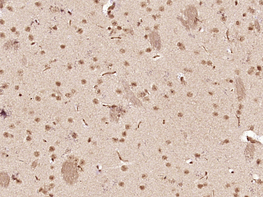 Paraformaldehyde-fixed, paraffin embedded Mouse brain; Antigen retrieval by boiling in sodium citrate buffer (pH6.0) for 15min; Block endogenous peroxidase by 3% hydrogen peroxide for 20 minutes; Blocking buffer (normal goat serum) at 37°C for 30min; Antibody incubation with SOX4 Polyclonal Antibody, Unconjugated (bs-11208R) at 1:400 overnight at 4°C, DAB staining.