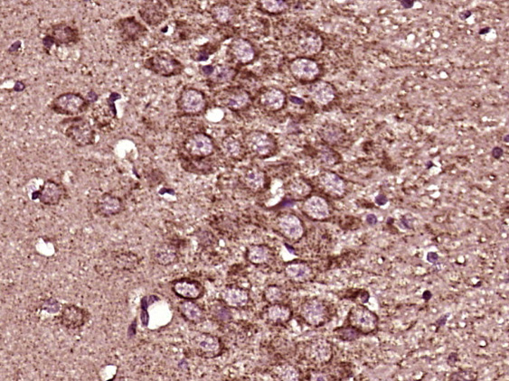 Paraformaldehyde-fixed, paraffin embedded Rat brain; Antigen retrieval by boiling in sodium citrate buffer (pH6.0) for 15min; Block endogenous peroxidase by 3% hydrogen peroxide for 20 minutes; Blocking buffer (normal goat serum) at 37°C for 30min; Antibody incubation with Zic1/ZNF201 Polyclonal Antibody, Unconjugated (bs-11609R) at 1:400 overnight at 4°C, DAB staining.