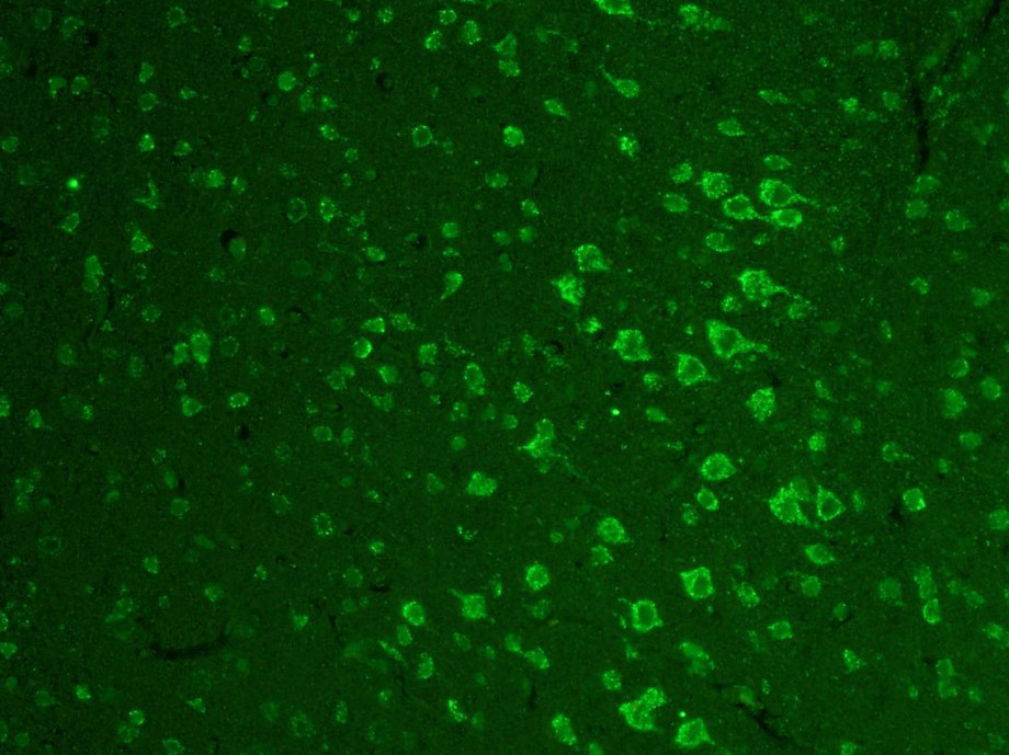 Paraformaldehyde-fixed, paraffin embedded Mouse brain; Antigen retrieval by boiling in sodium citrate buffer (pH6.0) for 15min; Block endogenous peroxidase by 3% hydrogen peroxide for 20 minutes; Blocking buffer (normal goat serum) at 37°C for 30min; Antibody incubation with Zic1/ZNF201 Polyclonal Antibody, Unconjugated (bs-11609R) at 1:400 overnight at 4°C, followed by a conjugated Goat Anti-Rabbit IgG antibody (bs-0295G-FITC) for 90 minutes, and DAPI for nuclei staining.