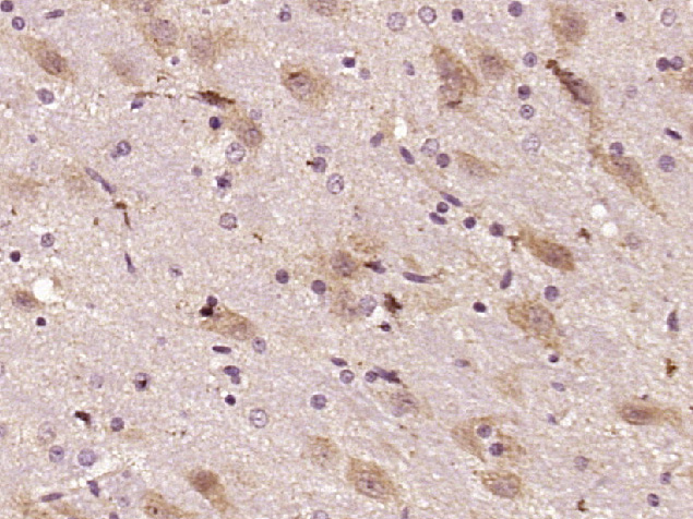 Paraformaldehyde-fixed, paraffin embedded Rat brain; Antigen retrieval by boiling in sodium citrate buffer (pH6.0) for 15min; Block endogenous peroxidase by 3% hydrogen peroxide for 20 minutes; Blocking buffer (normal goat serum) at 37°C for 30min; Antibody incubation with Shootin/KIAA1598 Polyclonal Antibody, Unconjugated (bs-11863R) at 1:400 overnight at 4°C, DAB staining.