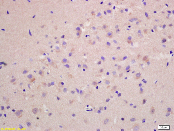 Formalin-fixed and paraffin embedded rat brain labeled with Anti-G protein alpha S Polyclonal Antibody, Unconjugated (bs-3939R) at 1:200 followed by conjugation to the secondary antibody and DAB staining.