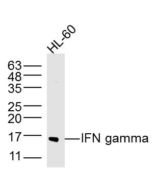 HL-60 lysates probed with IFN gamma Polyclonal Antibody, Unconjugated (bs-0481R) at 1:300 dilution and 4˚C overnight incubation. Followed by conjugated secondary antibody incubation at 1:10000 for 60 min at 37˚C.