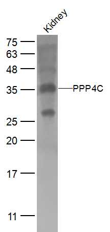 Mouse kidney lysates probed with PPP4C Polyclonal Antibody, Unconjugated (bs-0490R) at 1:500 dilution and 4˚C overnight incubation. Followed by conjugated secondary antibody incubation at 1:10000 for 60 min at 37˚C.