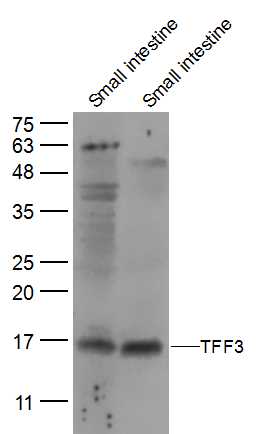 Lane 1: mouse small intestine lysates; Lane 2: Rat small intestine lysates probed with TFF3 Polyclonal Antibody, Unconjugated (bs-0535R) at 1:300 dilution and 4˚C overnight incubation. Followed by conjugated secondary antibody incubation at 1:10000 for 60 min at 37˚C.