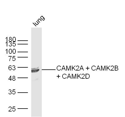 Mouse lung lysates probed with CAMK2A + CAMK2B + CAMK2D Polyclonal Antibody, Unconjugated (bs-0541R) at 1:300 dilution and 4˚C overnight incubation. Followed by conjugated secondary antibody incubation at 1:10000 for 60 min at 37˚C.