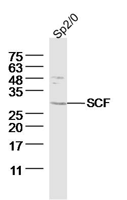 Sp2/0 (Mouse myeloma cell) lysates probed with SCF Polyclonal Antibody, Unconjugated (bs-0545R) at 1:300 dilution and 4˚C overnight incubation. Followed by conjugated secondary antibody incubation at 1:10000 for 60 min at 37˚C.