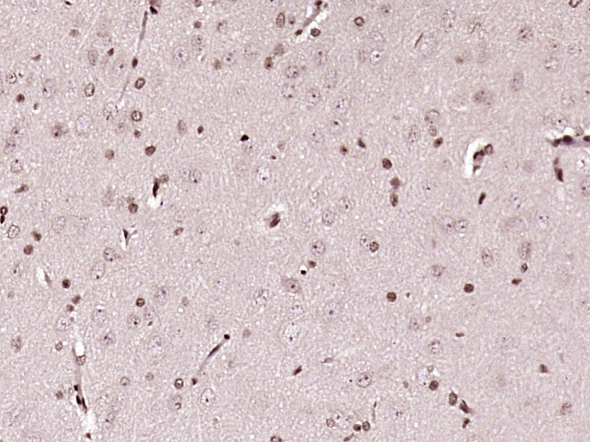 Paraformaldehyde-fixed, paraffin embedded rat brain tissue; Antigen retrieval by boiling in sodium citrate buffer (pH6.0) for 15min; Block endogenous peroxidase by 3% hydrogen peroxide for 20 minutes; Blocking buffer (normal goat serum) at 37°C for 30min; Antibody incubation with C1orf103 Polyclonal Antibody, Unconjugated (bs-15001R) at 1:400 overnight at 4°C, DAB staining.